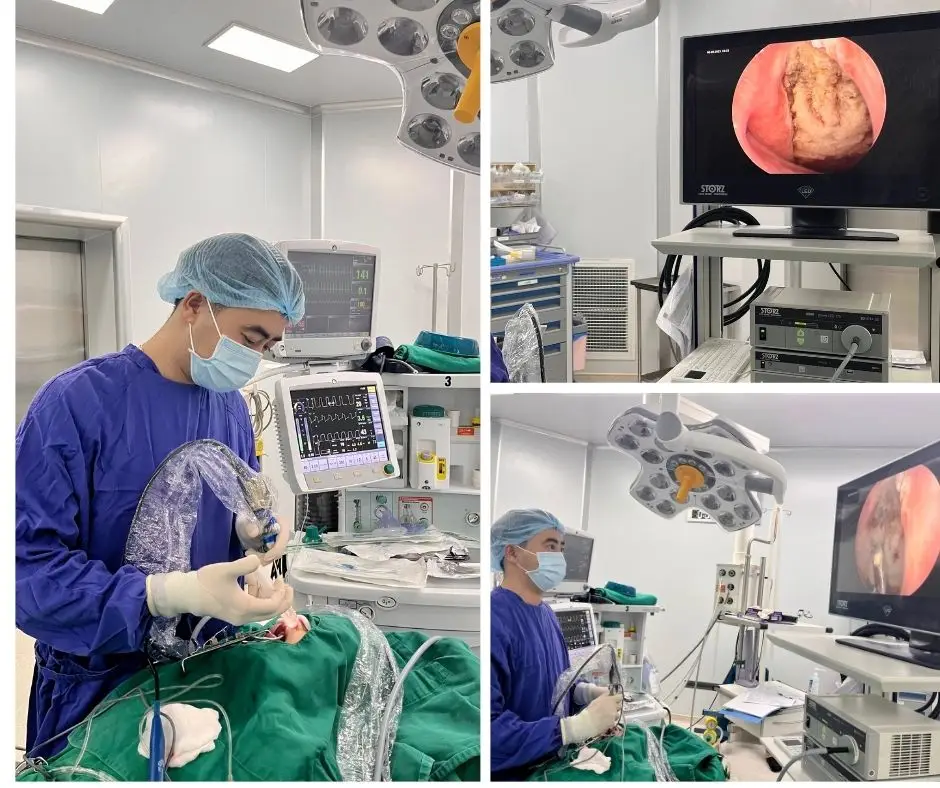 Read more about the article Dấu hiệu trẻ cần đi khám và xem xét nạo VA- Bác sĩ Đức – Nha Trang