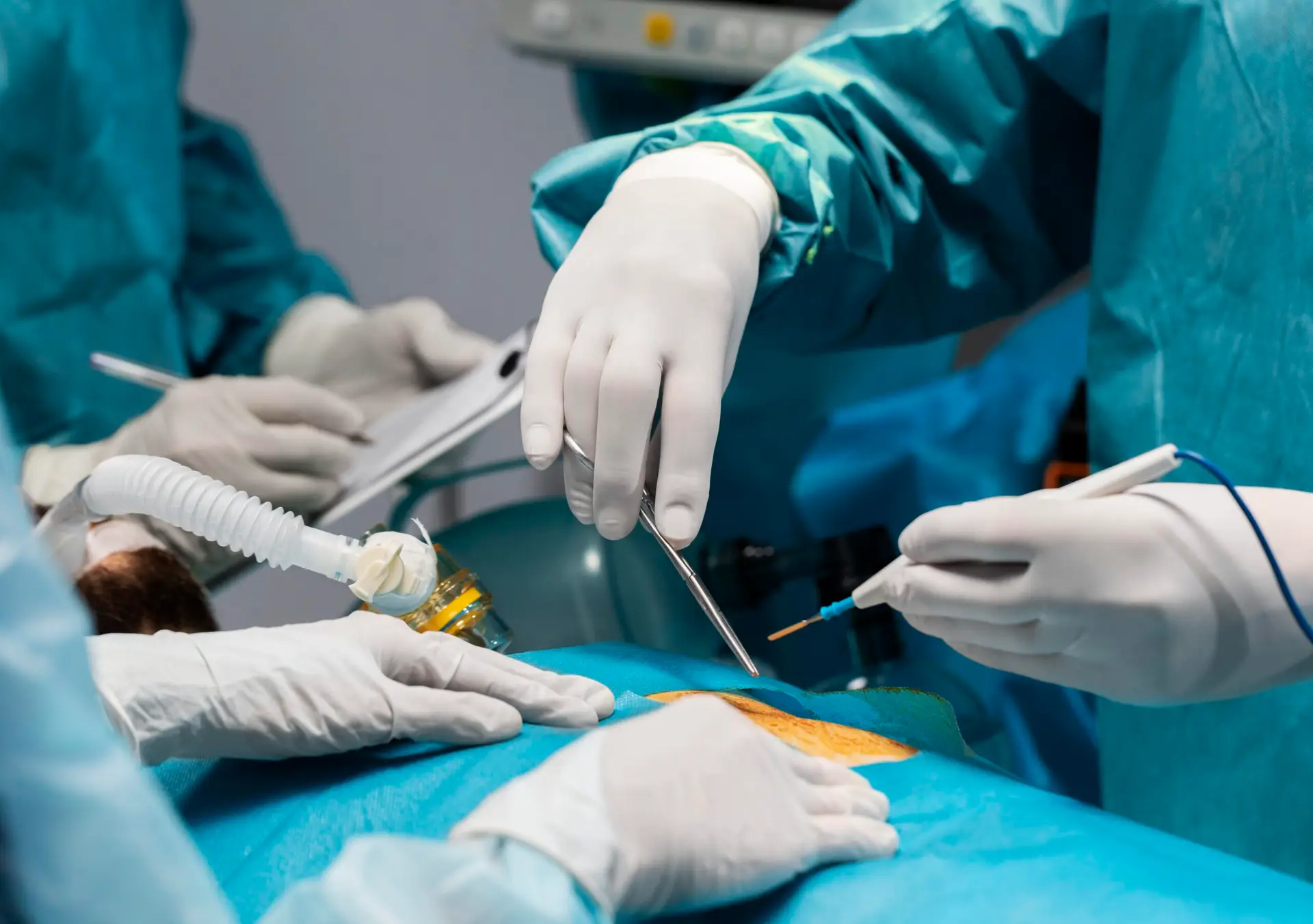 Read more about the article Dấu hiệu viêm amidan mạn tính ở trẻ – Có nên cắt amidan không?