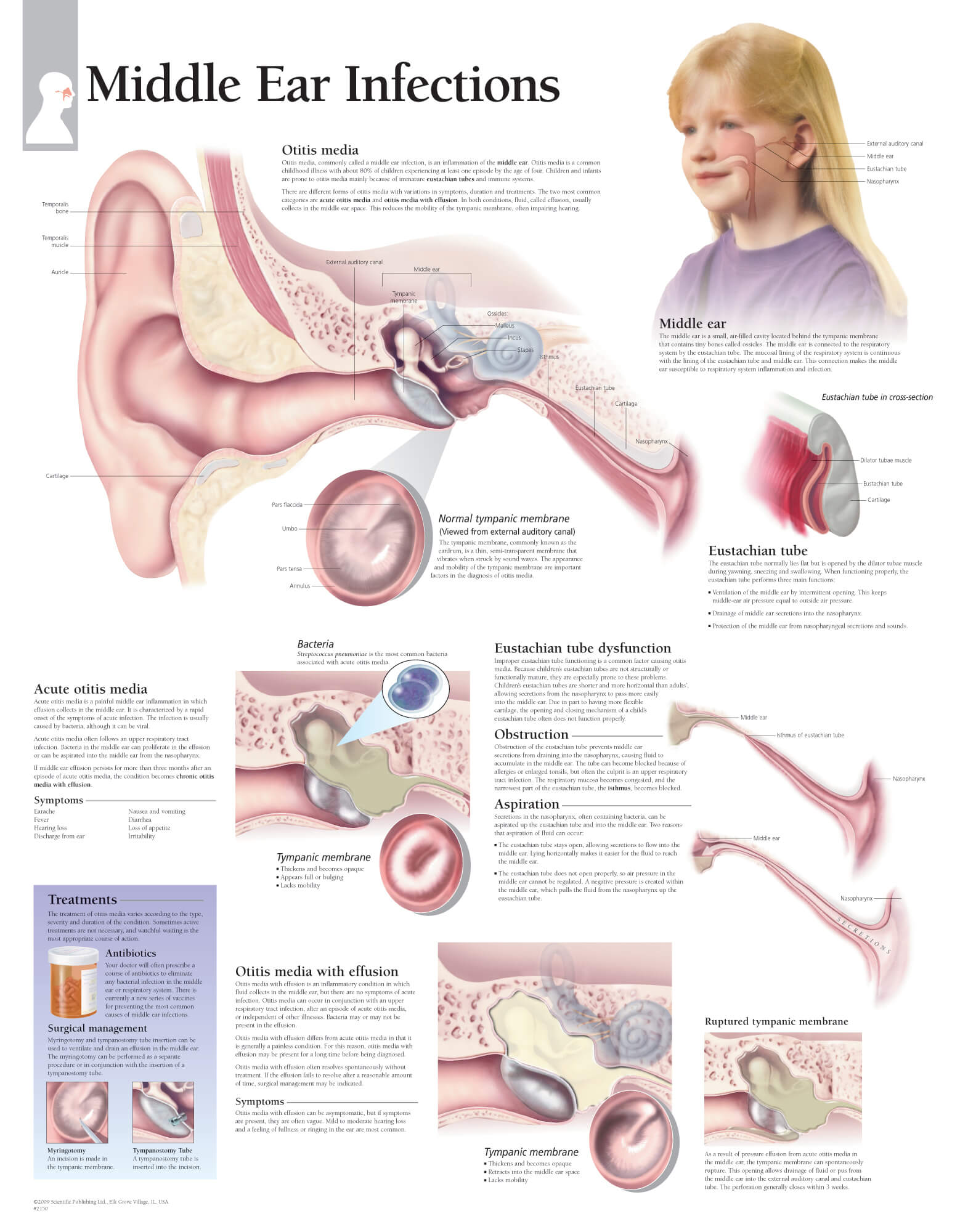Read more about the article Viêm tai giữa cấp ở trẻ em: Nguyên nhân và cách nhận biết sớm