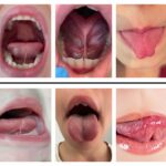 Cắt thắng lưỡi cho trẻ nhỏ có cần thiết không? Hiểu đúng và đủ – BS Đức Nha Trang